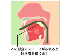 口からの胃内視鏡